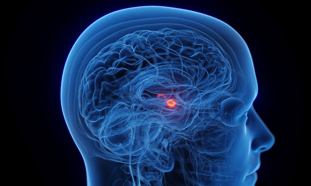 Eine 3D-Abbildung der Amygdala, dem Mandelkern, im menschlichen Gehirn 